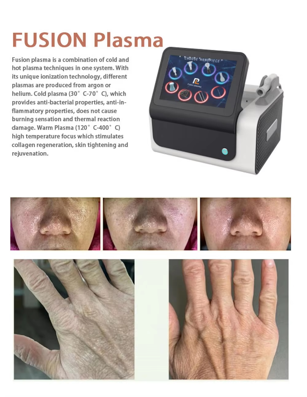Cool Ion Beauty Device Profess - Skincare Ls recension och pris